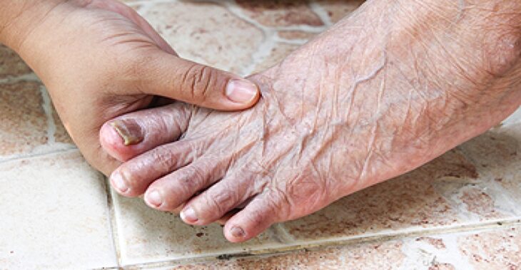 Why Professional Nail Care Is Important for Healthy Hands and Feet?